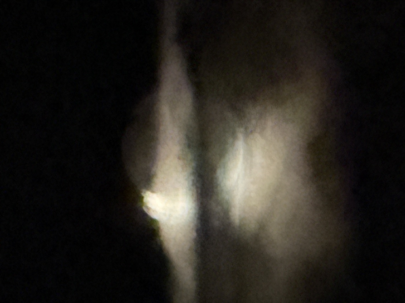 A mostly dark photograph with blurred light-colored shapes in the center, hard to identify.